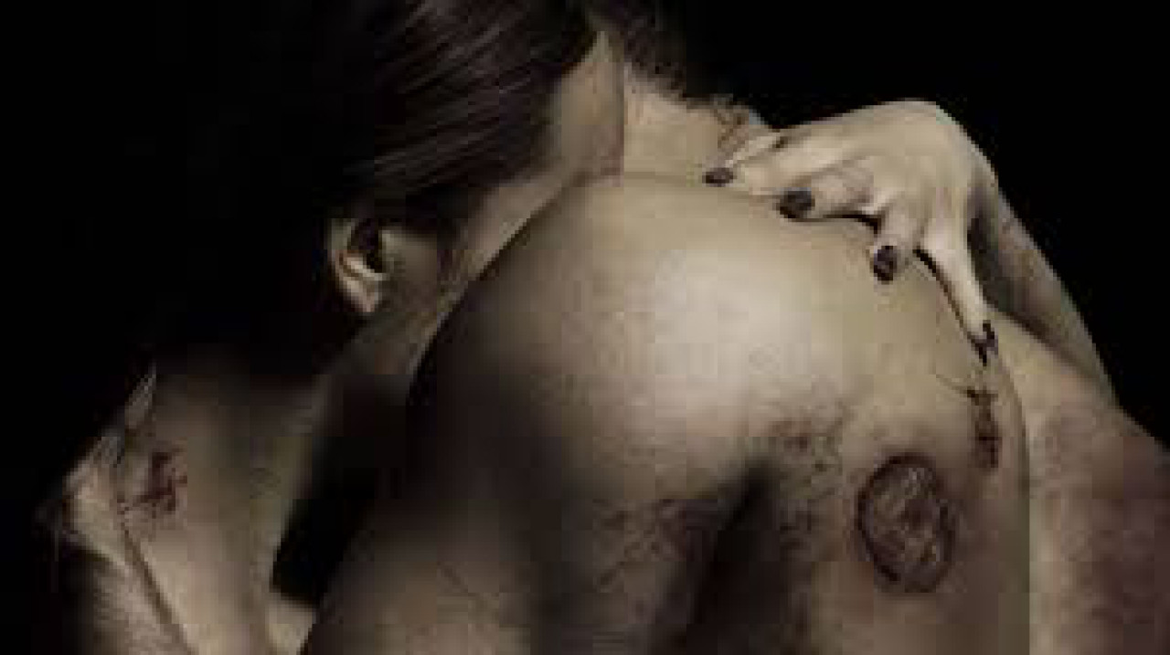 Xem Phim Căn Bệnh Quái Ác 2